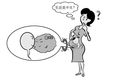 引产风险大不大