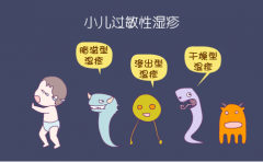 小儿过敏性湿疹有哪些常见症状