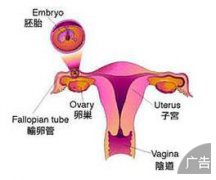 引起输卵管不孕的病因